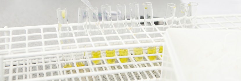 聚-3-羥基丁酸酯(PHB)檢測(cè)