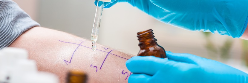 皮膚變態(tài)反應試驗