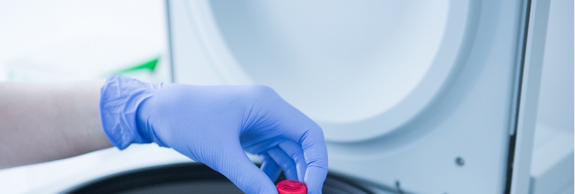 塑料阻燃抗沖擊聚苯乙烯專(zhuān)用料檢測(cè)